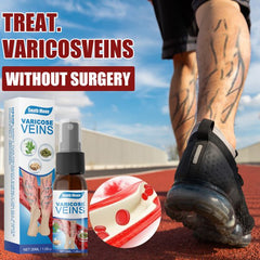 Veins Treatment Spray